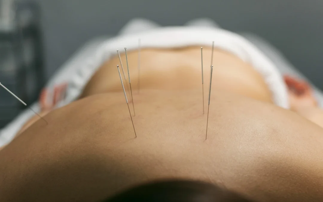 What is Arthritis and How Can Acupuncture Help