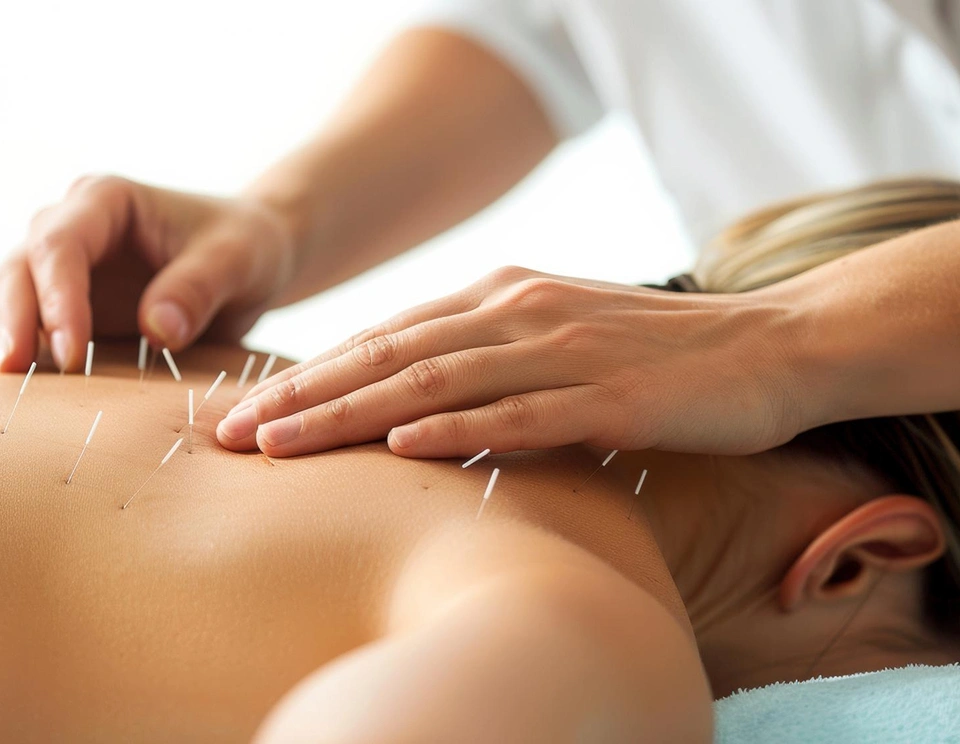 accupuncture-img